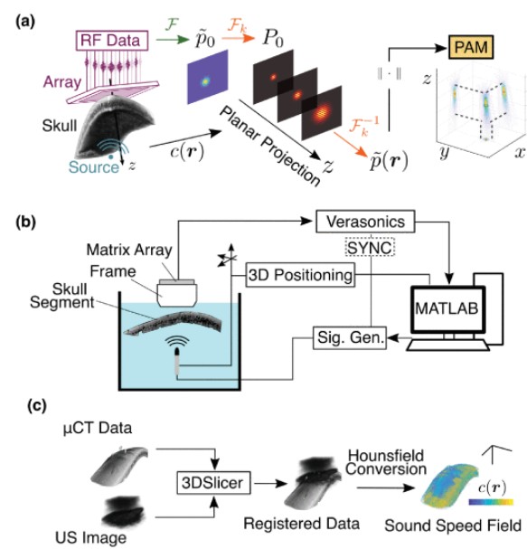 Experimental Demonstration of Trans-skull Volumetric Passive Acoustic Mapping with the Heterogeneous Angular Spectrum Approach