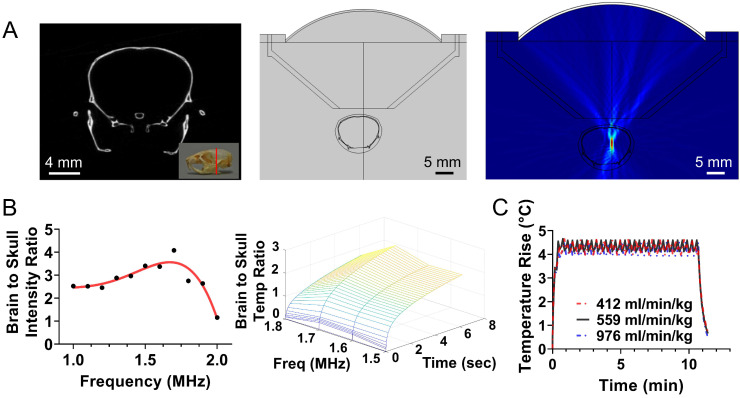 Closed-loop trans-skull ultrasound hyperthermia leads to improved drug delivery from thermosensitive drugs and changes the transvascular transport dynamics in brain tumors