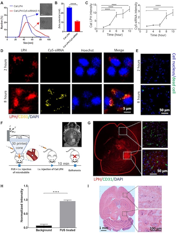Single-cell analysis reveals effective siRNA delivery in brain tumors with microbubble-enhanced ultrasound and cationic nanoparticles
