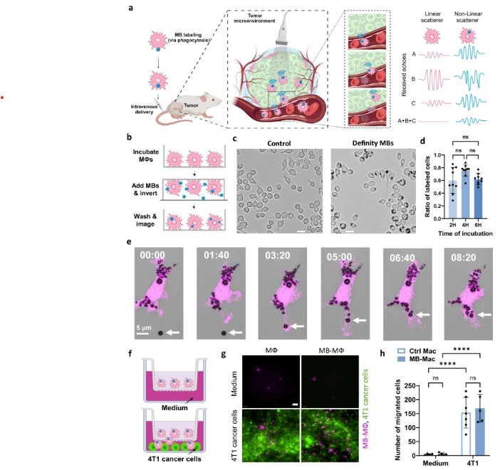 Imaging of macrophage accumulation in solid tumors with ultrasound