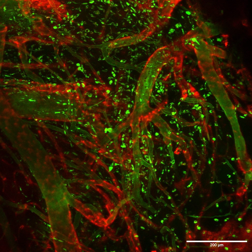 Multiscale Imaging