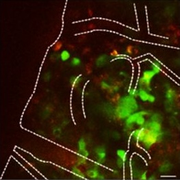 Targeted Delivery & Liquid Biopsy