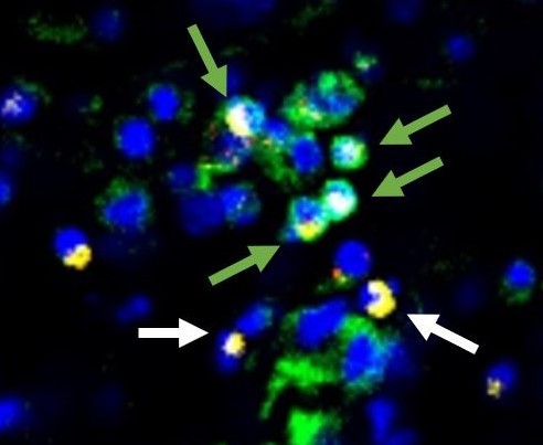 Biomolecular Transport
