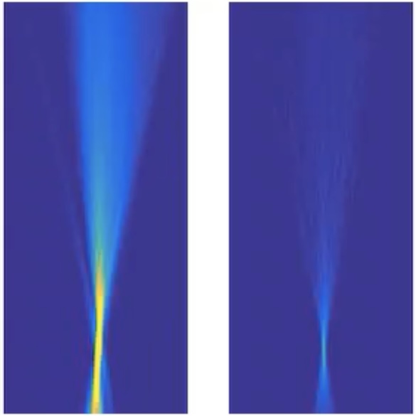 Image-Guided Focused Ultrasound